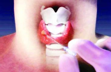 unnamed (4) كمكاري تيروئيد